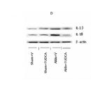 DF6252 at 1/100 staining Human Melanoma tissue by IHC-P. The sample was formaldehyde fixed and a heat mediated antigen retrieval step in citrate buffer was performed. The sample was then blocked and incubated with the antibody for 1.5 hours at 22¡ãC. An HRP conjugated goat anti-rabbit antibody was used as the secondary
