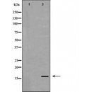 DF6256 at 1/100 staining Mouse liver tissue by IHC-P. The sample was formaldehyde fixed and a heat mediated antigen retrieval step in citrate buffer was performed. The sample was then blocked and incubated with the antibody for 1.5 hours at 22¡ãC. An HRP conjugated goat anti-rabbit antibody was used as the secondary