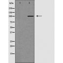 DF6257 at 1/100 staining Mouse colon tissue by IHC-P. The sample was formaldehyde fixed and a heat mediated antigen retrieval step in citrate buffer was performed. The sample was then blocked and incubated with the antibody for 1.5 hours at 22¡ãC. An HRP conjugated goat anti-rabbit antibody was used as the secondary