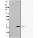 DF6260 at 1/100 staining Mouse testis tissue by IHC-P. The sample was formaldehyde fixed and a heat mediated antigen retrieval step in citrate buffer was performed. The sample was then blocked and incubated with the antibody for 1.5 hours at 22¡ãC. An HRP conjugated goat anti-rabbit antibody was used as the secondary