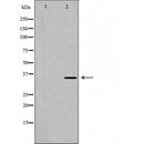 DF6261 at 1/100 staining Mouse testis tissue by IHC-P. The sample was formaldehyde fixed and a heat mediated antigen retrieval step in citrate buffer was performed. The sample was then blocked and incubated with the antibody for 1.5 hours at 22¡ãC. An HRP conjugated goat anti-rabbit antibody was used as the secondary