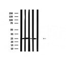DF6264 at 1/100 staining Mouse liver tissue by IHC-P. The sample was formaldehyde fixed and a heat mediated antigen retrieval step in citrate buffer was performed. The sample was then blocked and incubated with the antibody for 1.5 hours at 22¡ãC. An HRP conjugated goat anti-rabbit antibody was used as the secondary