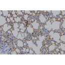 Western blot analysis of extracts from HepG2, using AMACR Antibody. The lane on the left was treated with blocking peptide.
