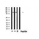 DF6269 at 1/100 staining Rat lung tissue by IHC-P. The sample was formaldehyde fixed and a heat mediated antigen retrieval step in citrate buffer was performed. The sample was then blocked and incubated with the antibody for 1.5 hours at 22¡ãC. An HRP conjugated goat anti-rabbit antibody was used as the secondary