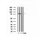 Western blot analysis of extracts from mouse brain, using RALBP1 Antibody. Lane 1 was treated with the antigen-specific peptide.