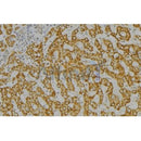Western blot analysis of extracts from various samples, using SH2D1A Antibody.
Lane 1: 293, treated with blocking peptide;
Lane 2: 293;
Lane 3: Rat lung.