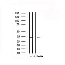 DF6279 at 1/100 staining Rat brain tissue by IHC-P. The sample was formaldehyde fixed and a heat mediated antigen retrieval step in citrate buffer was performed. The sample was then blocked and incubated with the antibody for 1.5 hours at 22¡ãC. An HRP conjugated goat anti-rabbit antibody was used as the secondary