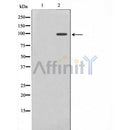 AF0639 staining HuvEc by IF/ICC. The sample were fixed with PFA and permeabilized in 0.1% Triton X-100,then blocked in 10% serum for 45 minutes at 25¡ãC. The primary antibody was diluted at 1/200 and incubated with the sample for 1 hour at 37¡ãC. An  Alexa Fluor 594 conjugated goat anti-rabbit IgG (H+L) Ab, diluted at 1/600, was used as the secondary antibod