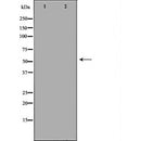DF6598 staining LOVO by IF/ICC. The sample were fixed with PFA and permeabilized in 0.1% Triton X-100,then blocked in 10% serum for 45 minutes at 25¡ãC. The primary antibody was diluted at 1/200 and incubated with the sample for 1 hour at 37¡ãC. An Alexa Fluor 594 conjugated goat anti-rabbit IgG (H+L) Ab, diluted at 1/600, was used as the secondary antibod