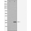 DF6616 at 1/100 staining Rat heart tissue by IHC-P. The sample was formaldehyde fixed and a heat mediated antigen retrieval step in citrate buffer was performed. The sample was then blocked and incubated with the antibody for 1.5 hours at 22¡ãC. An HRP conjugated goat anti-rabbit antibody was used as the secondary