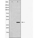 DF6617 at 1/100 staining Human liver tissue by IHC-P. The sample was formaldehyde fixed and a heat mediated antigen retrieval step in citrate buffer was performed. The sample was then blocked and incubated with the antibody for 1.5 hours at 22¡ãC. An HRP conjugated goat anti-rabbit antibody was used as the secondary