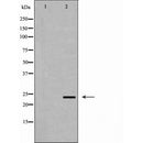 DF6623 at 1/100 staining Mouse liver tissue by IHC-P. The sample was formaldehyde fixed and a heat mediated antigen retrieval step in citrate buffer was performed. The sample was then blocked and incubated with the antibody for 1.5 hours at 22¡ãC. An HRP conjugated goat anti-rabbit antibody was used as the secondary