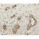 DF6647 staining HepG2? cells by IF/ICC. The sample were fixed with PFA and permeabilized in 0.1% Triton X-100,then blocked in 10% serum for 45 minutes at 25¡ãC. The primary antibody was diluted at 1/200 and incubated with the sample for 1 hour at 37¡ãC. An Alexa Fluor 594 conjugated goat anti-rabbit IgG (H+L) antibody(Cat.