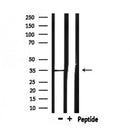 DF6657 at 1/100 staining Mouse spleen tissue by IHC-P. The sample was formaldehyde fixed and a heat mediated antigen retrieval step in citrate buffer was performed. The sample was then blocked and incubated with the antibody for 1.5 hours at 22¡ãC. An HRP conjugated goat anti-rabbit antibody was used as the secondary