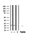 DF6660 staining Hela by IF/ICC. The sample were fixed with PFA and permeabilized in 0.1% Triton X-100,then blocked in 10% serum for 45 minutes at 25¡ãC. The primary antibody was diluted at 1/200 and incubated with the sample for 1 hour at 37¡ãC. An Alexa Fluor 594 conjugated goat anti-rabbit IgG (H+L) Ab, diluted at 1/600, was used as the secondary antibod