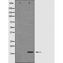 DF6664 at 1/100 staining Rat heart tissue by IHC-P. The sample was formaldehyde fixed and a heat mediated antigen retrieval step in citrate buffer was performed. The sample was then blocked and incubated with the antibody for 1.5 hours at 22¡ãC. An HRP conjugated goat anti-rabbit antibody was used as the secondary