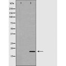 DF6697 at 1/100 staining Human prostate tissue by IHC-P. The sample was formaldehyde fixed and a heat mediated antigen retrieval step in citrate buffer was performed. The sample was then blocked and incubated with the antibody for 1.5 hours at 22¡ãC. An HRP conjugated goat anti-rabbit antibody was used as the secondary