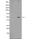 DF6705 at 1/100 staining Mouse testis tissue by IHC-P. The sample was formaldehyde fixed and a heat mediated antigen retrieval step in citrate buffer was performed. The sample was then blocked and incubated with the antibody for 1.5 hours at 22¡ãC. An HRP conjugated goat anti-rabbit antibody was used as the secondary
