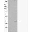 DF6793 at 1/100 staining Human lymph tissue by IHC-P. The sample was formaldehyde fixed and a heat mediated antigen retrieval step in citrate buffer was performed. The sample was then blocked and incubated with the antibody for 1.5 hours at 22¡ãC. An HRP conjugated goat anti-rabbit antibody was used as the secondary