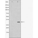 DF6832 at 1/100 staining Human lymph node tissue by IHC-P. The sample was formaldehyde fixed and a heat mediated antigen retrieval step in citrate buffer was performed. The sample was then blocked and incubated with the antibody for 1.5 hours at 22¡ãC. An HRP conjugated goat anti-rabbit antibody was used as the secondary