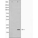 DF6899 at 1/100 staining Mouse liver tissue by IHC-P. The sample was formaldehyde fixed and a heat mediated antigen retrieval step in citrate buffer was performed. The sample was then blocked and incubated with the antibody for 1.5 hours at 22¡ãC. An HRP conjugated goat anti-rabbit antibody was used as the secondary