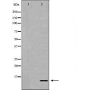 DF6954 staining Hela by IF/ICC. The sample were fixed with PFA and permeabilized in 0.1% Triton X-100,then blocked in 10% serum for 45 minutes at 25¡ãC. The primary antibody was diluted at 1/200 and incubated with the sample for 1 hour at 37¡ãC. An Alexa Fluor 594 conjugated goat anti-rabbit IgG (H+L) Ab, diluted at 1/600, was used as the secondary antibod