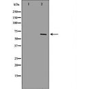DF7003 at 1/100 staining Human kidney tissue by IHC-P. The sample was formaldehyde fixed and a heat mediated antigen retrieval step in citrate buffer was performed. The sample was then blocked and incubated with the antibody for 1.5 hours at 22¡ãC. An HRP conjugated goat anti-rabbit antibody was used as the secondary