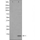 DF7024 at 1/100 staining Human heart tissue by IHC-P. The sample was formaldehyde fixed and a heat mediated antigen retrieval step in citrate buffer was performed. The sample was then blocked and incubated with the antibody for 1.5 hours at 22¡ãC. An HRP conjugated goat anti-rabbit antibody was used as the secondary