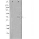 DF7104 at 1/100 staining Human liver cancer tissue by IHC-P. The sample was formaldehyde fixed and a heat mediated antigen retrieval step in citrate buffer was performed. The sample was then blocked and incubated with the antibody for 1.5 hours at 22¡ãC. An HRP conjugated goat anti-rabbit antibody was used as the secondary