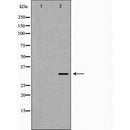 DF7142 staining HeLa by IF/ICC. The sample were fixed with PFA and permeabilized in 0.1% Triton X-100,then blocked in 10% serum for 45 minutes at 25¡ãC. The primary antibody was diluted at 1/200 and incubated with the sample for 1 hour at 37¡ãC. An Alexa Fluor 594 conjugated goat anti-rabbit IgG (H+L) Ab, diluted at 1/600, was used as the secondary antibod