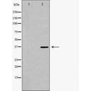 DF7166 at 1/100 staining Mouse kidney tissue by IHC-P. The sample was formaldehyde fixed and a heat mediated antigen retrieval step in citrate buffer was performed. The sample was then blocked and incubated with the antibody for 1.5 hours at 22¡ãC. An HRP conjugated goat anti-rabbit antibody was used as the secondary