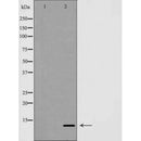 DF7269 at 1/100 staining Rat lung tissue by IHC-P. The sample was formaldehyde fixed and a heat mediated antigen retrieval step in citrate buffer was performed. The sample was then blocked and incubated with the antibody for 1.5 hours at 22¡ãC. An HRP conjugated goat anti-rabbit antibody was used as the secondary