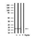 DF7330 at 1/100 staining Mouse liver tissue by IHC-P. The sample was formaldehyde fixed and a heat mediated antigen retrieval step in citrate buffer was performed. The sample was then blocked and incubated with the antibody for 1.5 hours at 22¡ãC. An HRP conjugated goat anti-rabbit antibody was used as the secondary
