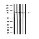 DF7340 at 1/100 staining Human Melanoma tissue by IHC-P. The sample was formaldehyde fixed and a heat mediated antigen retrieval step in citrate buffer was performed. The sample was then blocked and incubated with the antibody for 1.5 hours at 22¡ãC. An HRP conjugated goat anti-rabbit antibody was used as the secondary