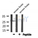 DF7342 at 1/100 staining Rat liver tissue by IHC-P. The sample was formaldehyde fixed and a heat mediated antigen retrieval step in citrate buffer was performed. The sample was then blocked and incubated with the antibody for 1.5 hours at 22¡ãC. An HRP conjugated goat anti-rabbit antibody was used as the secondary