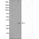 DF7393 at 1/100 staining Human prostate tissue by IHC-P. The sample was formaldehyde fixed and a heat mediated antigen retrieval step in citrate buffer was performed. The sample was then blocked and incubated with the antibody for 1.5 hours at 22¡ãC. An HRP conjugated goat anti-rabbit antibody was used as the secondary