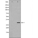DF7394 at 1/100 staining Human gastric tissue by IHC-P. The sample was formaldehyde fixed and a heat mediated antigen retrieval step in citrate buffer was performed. The sample was then blocked and incubated with the antibody for 1.5 hours at 22¡ãC. An HRP conjugated goat anti-rabbit antibody was used as the secondary