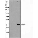 Western blot analysis of recombinant protein using Rabl2 antibody. The lane on the left is treated with the antigen-specific peptide.