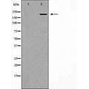DF7464 at 1/100 staining Human lymph tissue by IHC-P. The sample was formaldehyde fixed and a heat mediated antigen retrieval step in citrate buffer was performed. The sample was then blocked and incubated with the antibody for 1.5 hours at 22¡ãC. An HRP conjugated goat anti-rabbit antibody was used as the secondary