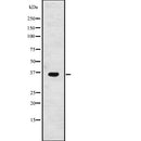 Western blot analysis of GPSN2 expression in A2058 cell lysate ,The lane on the left is treated with the antigen-specific peptide.