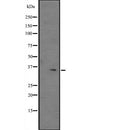 Western blot analysis of Max expression in immunised recombinant protein,The lane on the left is treated with the antigen-specific peptide.