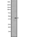 DF2776 at 1/100 staining Mouse lung tissue by IHC-P. The sample was formaldehyde fixed and a heat mediated antigen retrieval step in citrate buffer was performed. The sample was then blocked and incubated with the antibody for 1.5 hours at 22¡ãC. An HRP conjugated goat anti-rabbit antibody was used as the secondary