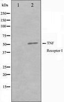 Western blot analysis of TNFR1 Antibody expression in A549 cells lysates.The lane on the left is treated with the antigen-specific peptide.