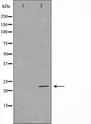 Western blot analysis on HuvEc cell lysate using TFIP8 Antibody,The lane on the left is treated with the antigen-specific peptide.