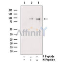 Phospho-STAT1 (Tyr701) Antibody