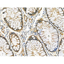 Phospho-BLNK (Tyr84) Antibody -AF3566