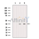 Western blot analysis of extracts from various samples, using SCF Antibody.
Lane 1: 3T3 treated with blocking peptide;
Lane 2: 3T3;
Lane 3: COS-7.
