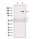 AF5155 staining Hela by IF/ICC. The samples were fixed with PFA and permeabilized in 0.1% Triton X-100,then blocked in 10% serum for 45 minutes at 25¡ãC. Samples were then incubated with primary Ab(AF5155 1:200) and mouse anti-beta tubulin Ab(T0023 1:200) for 1 hour at 37¡ãC. An AlexaFluor594 conjugated goat anti-rabbit IgG(H+L) Ab(S0006 1:200 Red) and an AlexaFluor488 conjugated goat anti-mouse IgG(H+L) Ab(S0017 1:600 Green) were used as the secondary antibod