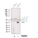 Western blot analysis of extracts from HeLa cells, using THA11 Antibody. The lane on the left was treated with blocking peptide.