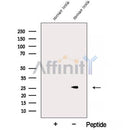 Western blot analysis of extracts from Rat kidney, using ARD1B Antibody. The lane on the left was treated with blocking peptide.